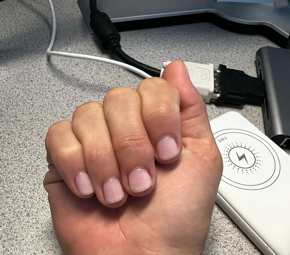 Client's nails 7 days after their first hypnosis session